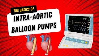 Intra Aortic Balloon Pumps: What Nurses Should Know about IABP