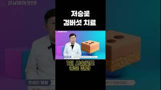 저승꽃 검버섯 치료 증상에 따라 1-2회 치료 #검버섯#검버섯제거