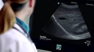 Introducing the Sonosite X-Porte Kiosk Ultrasound System