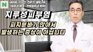 4K 지루성피부염은 피지분비가 많아서 발생하는 증상이 아니고 체온조절 작용이 떨어져 발생하는 증상입니다.