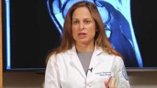 Dr. Sabrina Strickland explains Meniscal Tears and Meniscectomy