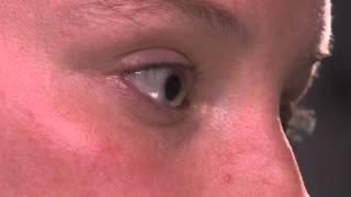 Removing Scleral Lens-Pop-Out Method