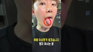 혀에 이상한게 생겼습니다. 뭔지 아시는 분!
