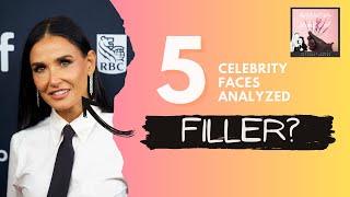 5 Celebrity Faces Analyzed  - Aesthetics Unfiltered Podcast