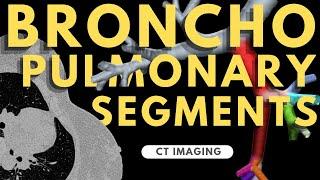 Segmental anatomy of the lung | Radiology anatomy part 1 prep | Bronchopulmonary segments on CT