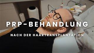 Ich nehme euch mit zur 1. PRP Behandlung + ein Monat nach der HT