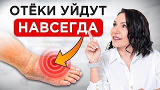 Как ИЗБАВИТЬСЯ от отеков РАЗ и НАВСЕГДА? / Причины отечности