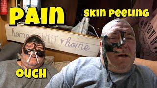 Wife Causing Pain To Husband WAXING & Facial!