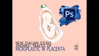 Microplastics in the Human Placenta found in a study in Rome Ep.7