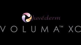 Juvederm Voluma XC | Nashville, TN | Dr J J Wendel Plastic Surgery