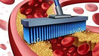 очистка сосудов/ Медовик Травник/ Павел Литовкин/ www.medbka.ru