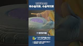 경추척수증 비수술치료, 수술적치료 #청주병원 #청주정형외과 #청주프라임병원 #척관병원 #척추병원 #경추