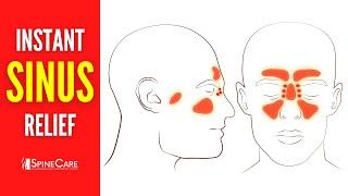 How to Relieve Sinus Congestion in 30 SECONDS