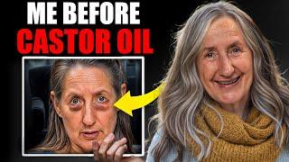 I Removed My Eye Bags in 30 Days With Castor Oil—Here’s How! | Barbara O’Neill