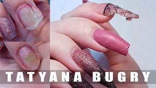 Chewed Up Nails??? | Bacteria On Nails | How I Restored My Nails