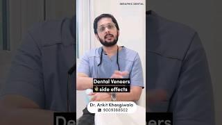 Dental Veneers के Side Effects #dentalveneers #dentalclinic #shorts #youtubeshorts #teeth #dentist