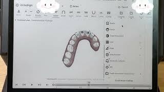 Using Invisalign Clincheck Software via E Ink Reflective Display