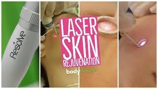 What is Laser Skin Rejuvenation? |  Body Details