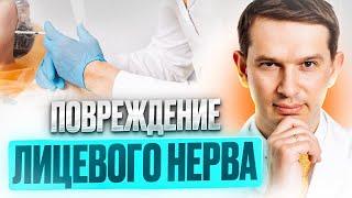 Повреждение лицевого нерва