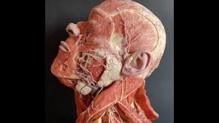 Facial muscles:Mușchii feței plastinated model