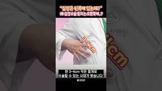 심장은 왼쪽에 있는데, 왜 오른쪽으로 수술하죠?  #Shorts