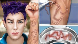 ASMR remove giant roundworm in Thanos's arm
