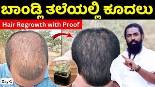 ಬಾಂಡ್ಲಿ ತಲೆಯಲ್ಲಿ ಕೂದಲು ಬರಬೇಕಾ| Hair Oil for Hair Growth Kannada | Men Hair Oil Kannada | Oil Kannada