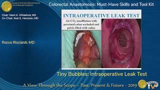 Tiny Bubbles: Intraoperative Leak Test Testing