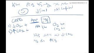 Bipap NIPPV (non invasive positive pressure ventilation) - Dr Jamal USMLE