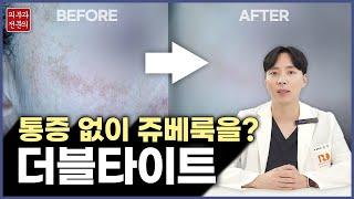 더블타이트 ｜ 쥬베룩, 스킨부스터를 통증, 다운타임 없이 받는 방법!