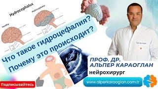 Что такое гидроцефалия? Почему это происходит? | Проф. Др. Альпер КАРАОГЛАН