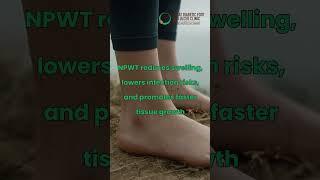 Why choose NPWT? | Diabetic Clinic | Surat Diabetic Clinic #foothealth #diabeticfoot