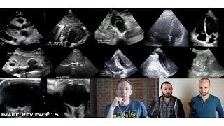 Core Ultrasound Image Review #15