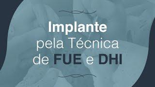 Implante Capilar - FUE & DHI