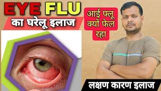 Eye Flu : Conjunctivitis यानी Eye Flu क्यों होता है? आई फ्लू का इलाज और घरेलू उपाय