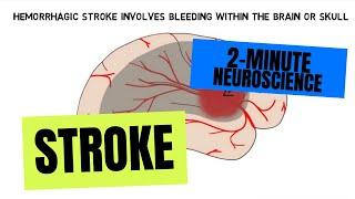 2-Minute Neuroscience: Stroke