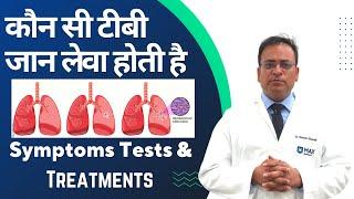 कौन सी टीबीजन लेवा होती है Symptoms Tests  Treatments #tb #tuberculosis #savelungcenter