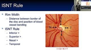 Lecture: Examining the Optic Nerve