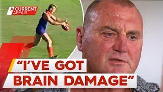 Former footballer pleads for AFL support in CTE battle | A Current Affair