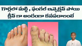 DIY Remedy to Get Beautiful Nails | Reduces Fungal Infections | Soft Nails |Dr.Manthena's Beauty Tip