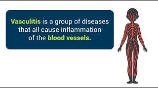 What is Vasculitis?