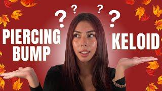 Piercing Bumps vs Keloids: What's the Difference?