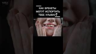 КАК БРЕКЕТЫ МОГУТ ИСПОРТИТЬ ТЕБЕ УЛЫБКУ? #miraclinic #брекеты #зубы
