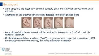 Webinar: Imaging in patients with Aural Atresia; Why and when