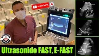 Ultrasonido FAST, E-FAST en menos de 3 minutos! By Orlando Pérez-Nieto