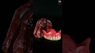 iDENTical Dental Model for Overdenture Maxilla M6001 - Maxillary Overdenture Anatomy #shorts