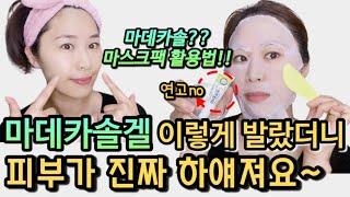 진짜 완전 꿀팁!! 비싼 레이져 시술보다 더 빠른주름재생관리 비법“1위”(마데카솔겔 구매방법!!)