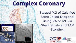 Staged PCI of Calcified Stent Jailed Diagonal using RA or IVL via Stent Struts and TAP Stenting