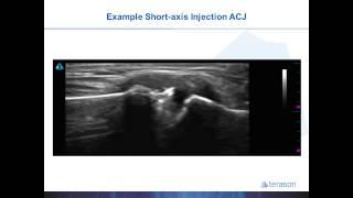 Introduction to MSK Ultrasound Guided Procedures with Dr. Gruba Part 2