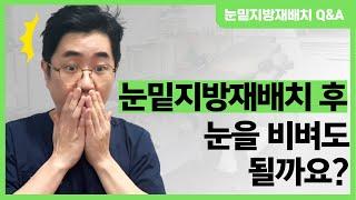 눈밑지방재배치 후에 눈을 비벼도 될까요?